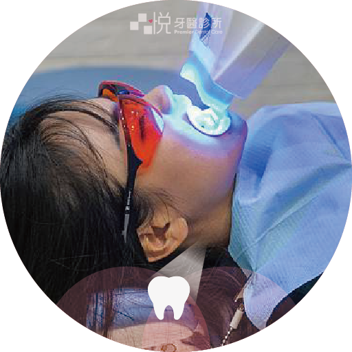 ❹ 開始進行冷光美白（約1小時）