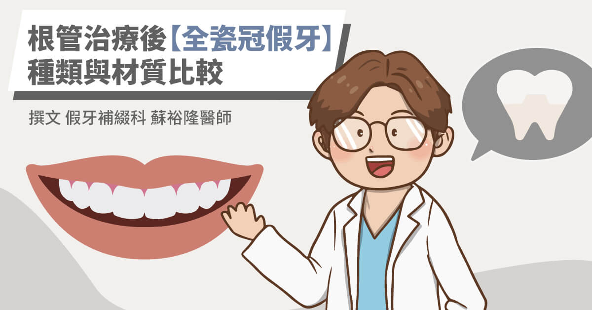 2024根管治療後【全瓷冠假牙】種類與材質比較