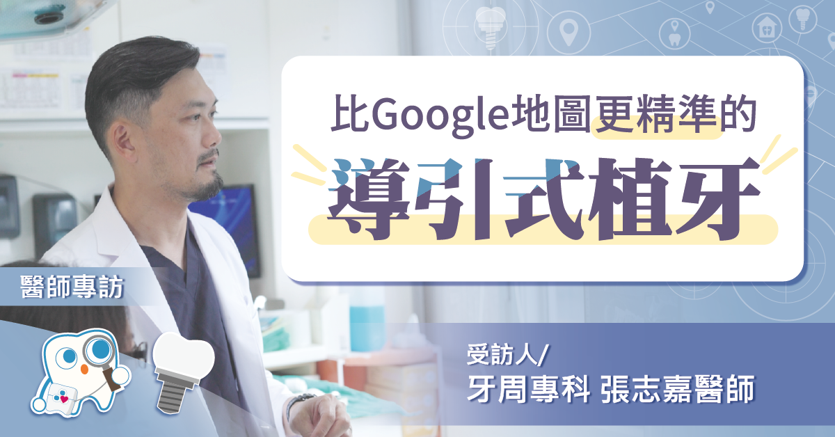 別等到植牙失敗才後悔沒看過這篇文章，推薦比Google地圖更精準的導引式植牙！【竹北植牙推薦】