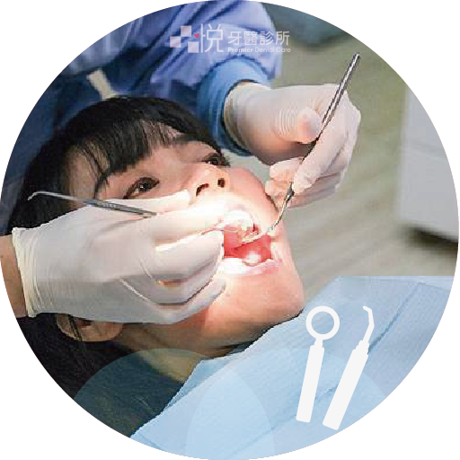 ❶ 醫師評估，取模製作全客製化個人美白牙托