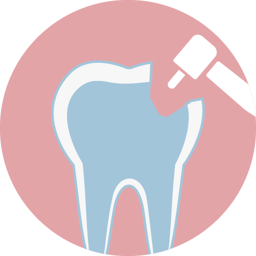 ❷ 將原蛀牙挖除乾淨