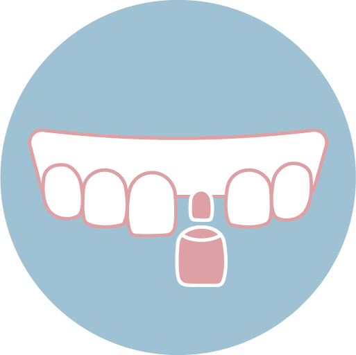 ❸ 裝戴臨時假牙