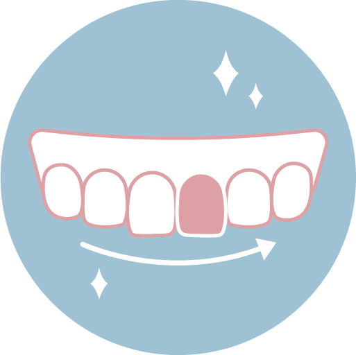 ❹ 配戴正式假牙與定期回診