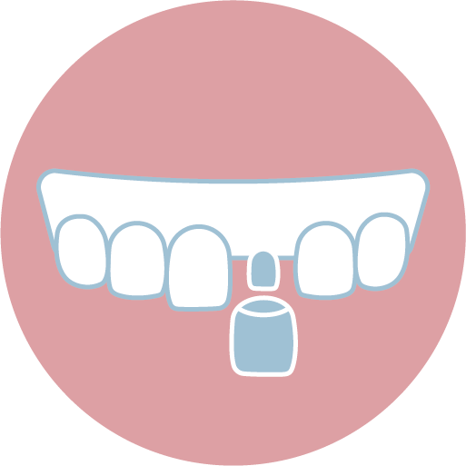 ❸ 裝戴臨時假牙