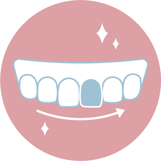 ❹ 配戴正式假牙與定期回診