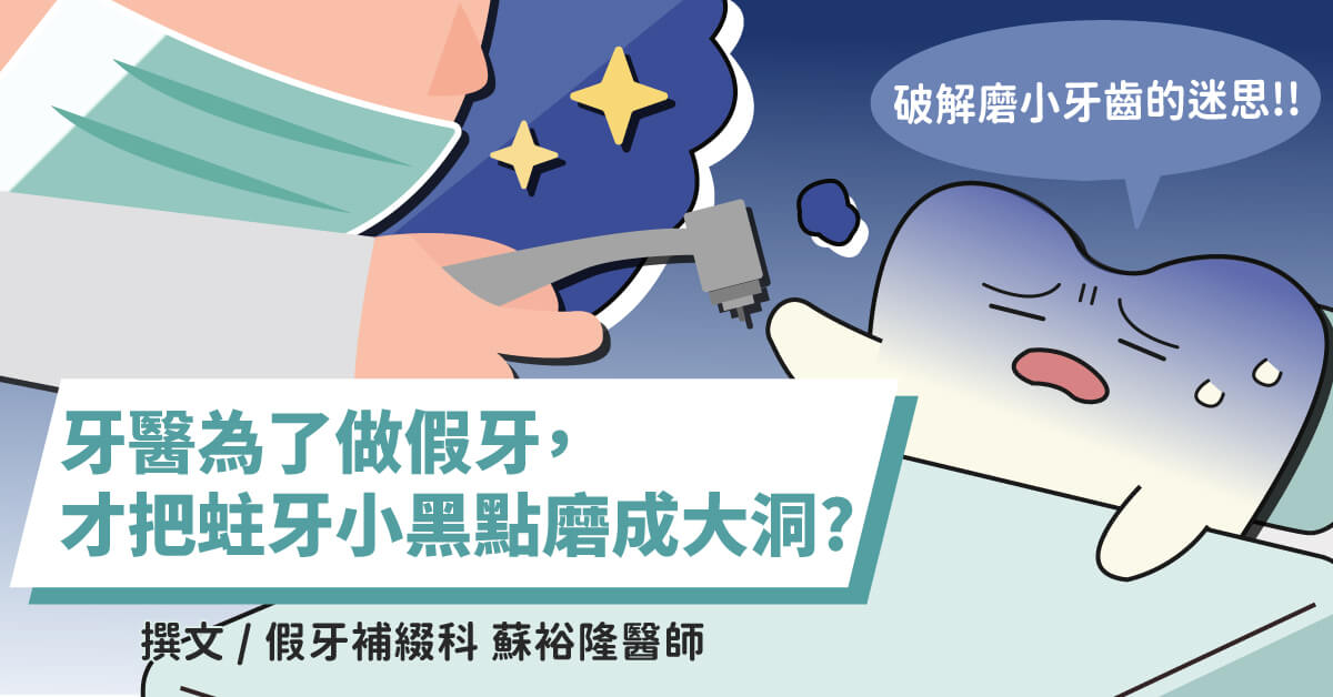 牙醫為了做假牙，才把蛀牙小黑點磨成大洞？破解磨小牙齒的迷思