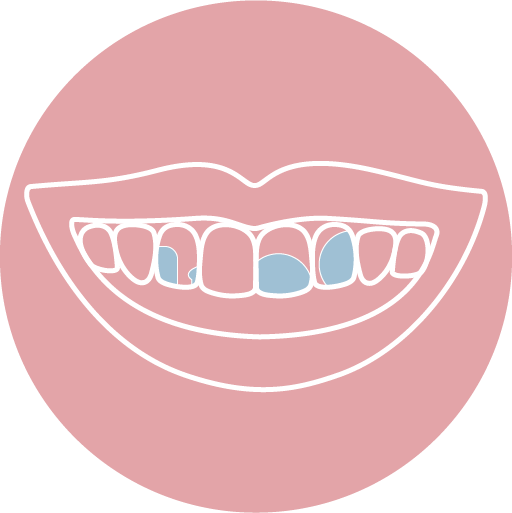 蛀牙或舊有補牙變色