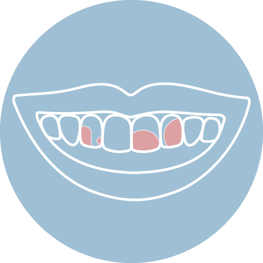 蛀牙或舊有補牙變色