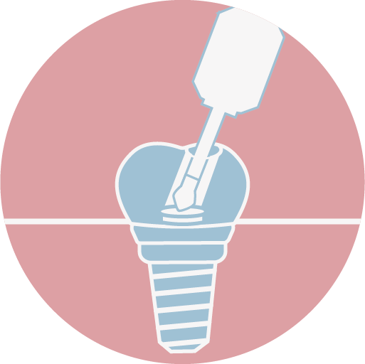 螺絲固持式假牙