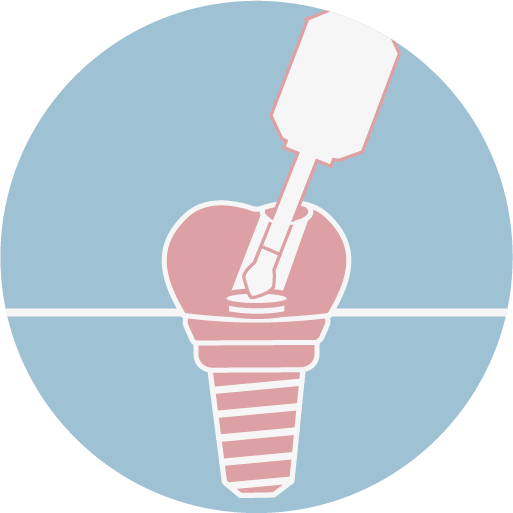 螺絲固持式假牙