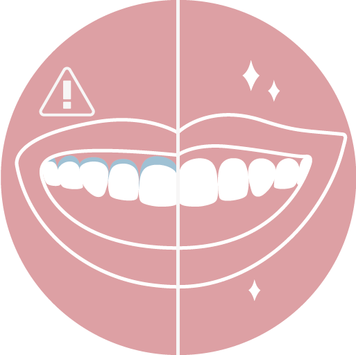 不會有牙齦染黑痕跡