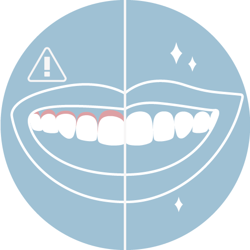 不會有牙齦染黑痕跡